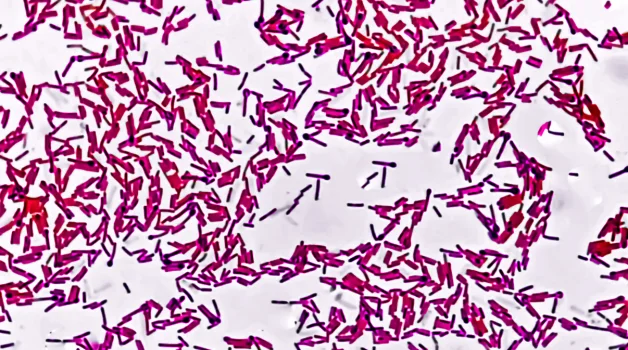 Not All Sporicidal Agents Are Equivalent